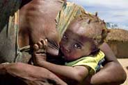 Angola photo3: la malnutrition/the malnutrition